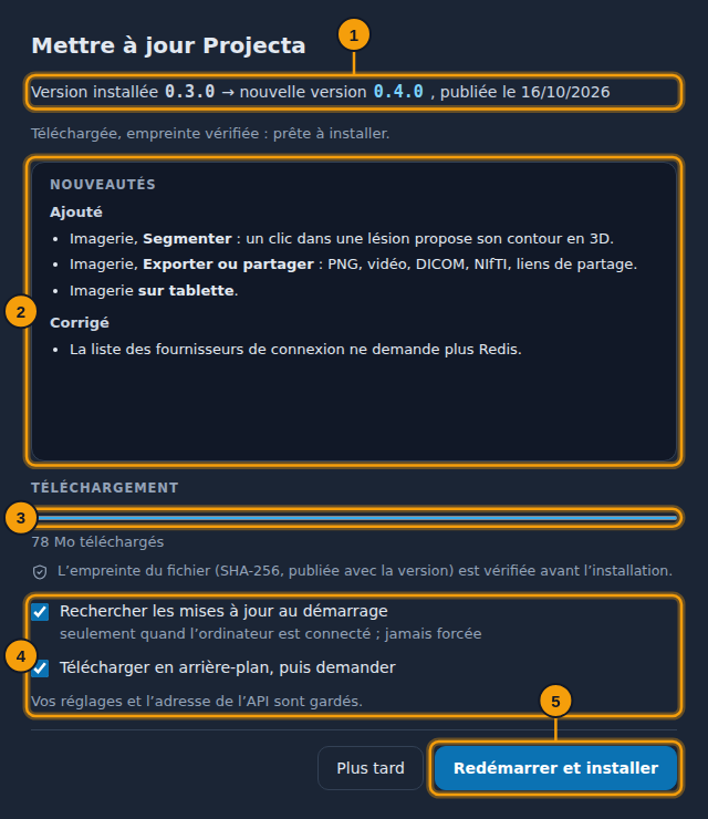 La fenêtre Mettre à jour Projecta