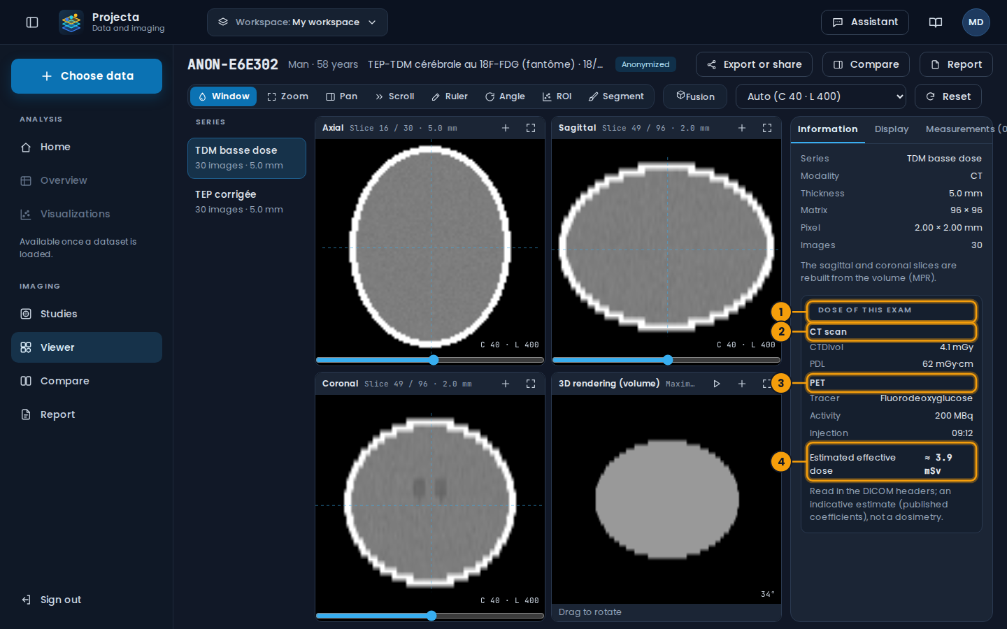 The dose of a PET-CT