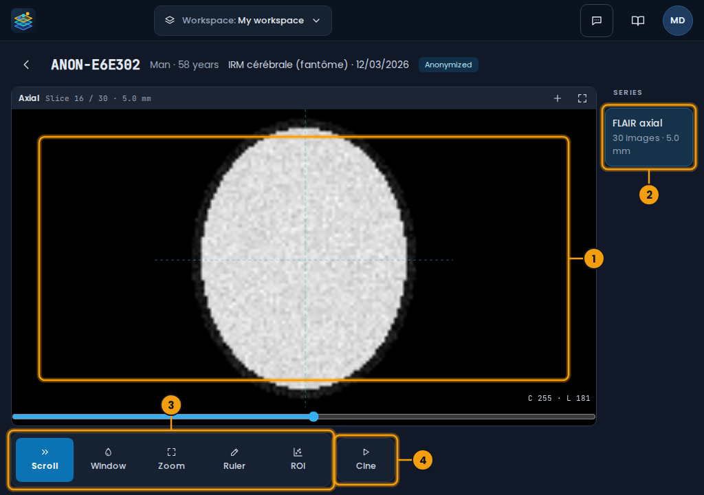 The viewer on a tablet